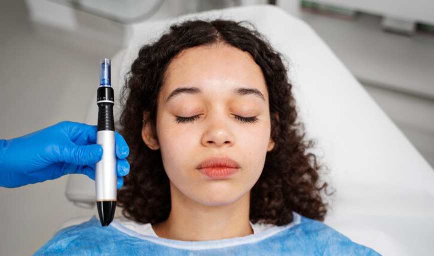 MICRONEEDLING